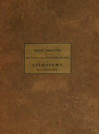 A Short Treatise on the Section of the Prostate Gland in Lithotomy: With an Explanation of a Safe and Easy Method of Conducting the Operation on the Principles of Cheselden