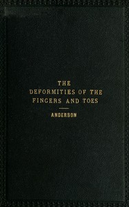 The deformities of the fingers and toes