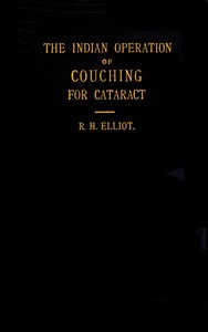 The Indian operation of couching for cataract